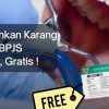 Ingin Gigi Bersih Tanpa Biaya? Begini Cara Mendapatkan Scaling Gigi Gratis dengan BPJS Kesehatan