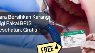 Ingin Gigi Bersih Tanpa Biaya? Begini Cara Mendapatkan Scaling Gigi Gratis dengan BPJS Kesehatan