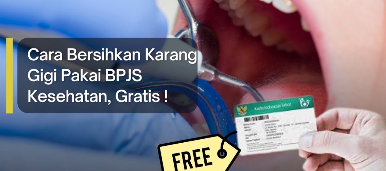 Ingin Gigi Bersih Tanpa Biaya? Begini Cara Mendapatkan Scaling Gigi Gratis dengan BPJS Kesehatan